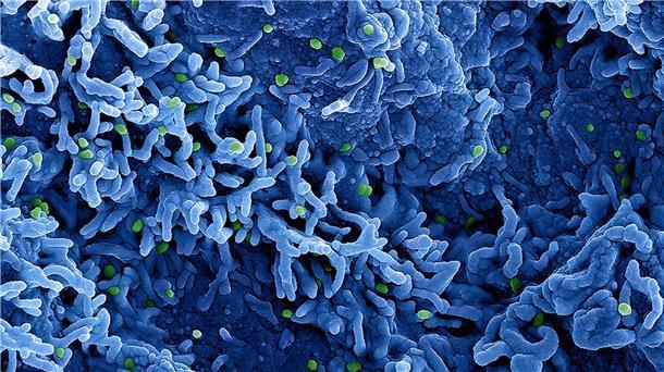 Neuer Name: Affenpocken werden ab sofort Mpox genannt Affenpocken heißen nun Mpox statt Monkeypox. Auch das Virus selbst soll umbenannt werden.