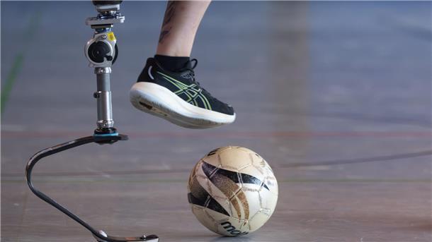 Alltagsprothesen sind für den Einsatz beim Sport nicht ausgelegt.