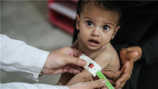Hilfsorganisation: Weltweit hungern 733 Millionen Menschen Auch in Syrien ist die Lage nach Einschätzung der Welthungerhilfe katastrophal.