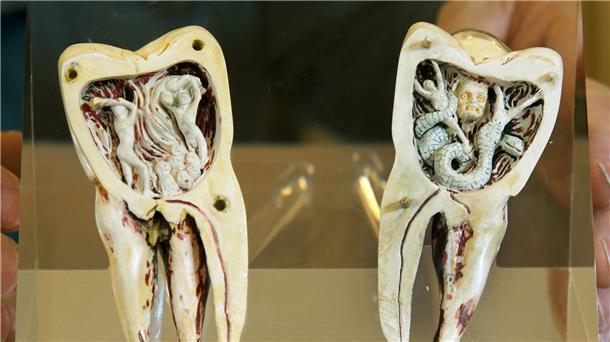 Dentalmuseum zeigt Skurriles und Religiöses Auch Kunst, wie diese Elfenbeinschnitzerei aus Südfrankreich, ist in der Ausstellung zu sehen.