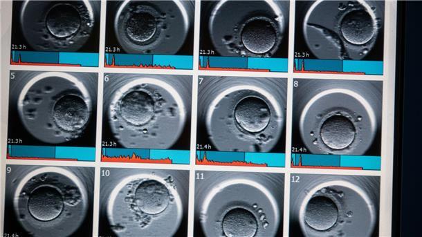 Frau mit krankem Mann darf Embryo-Gentest absetzen Auf dem Monitor sind Aufnahmen von Embryonen zu sehen.
