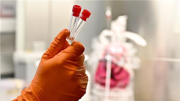 Bei jedem Patienten mit einem Coronaverdacht wird ein Abstrich genommen. Das Ergebnis steht nach 12 bis 24 Stunden fest.