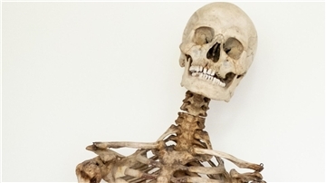 Dank wissenschaftlicher Analysen und eines Verwandten weiß man nun, dass dieses Skelett die sterblichen Überreste des Räubers Schinderhannes sind.