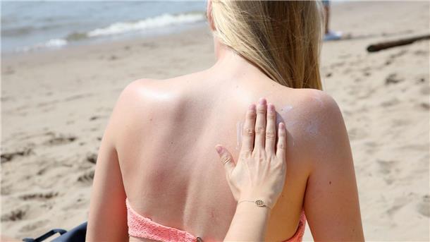 Sommer-Zeit ist Sonnenschutz-Zeit „Das Risiko, einen Sonnenbrand zu bekommen, ist abhängig vom Sonnenstand und in den Sommermonaten von Juni bis August sowie in der Mittagszeit zwischen 11 und 15 Uhr besonders hoch“, sagte der Dermatologe Mark Berneburg der Deutschen Presse-Agentur.