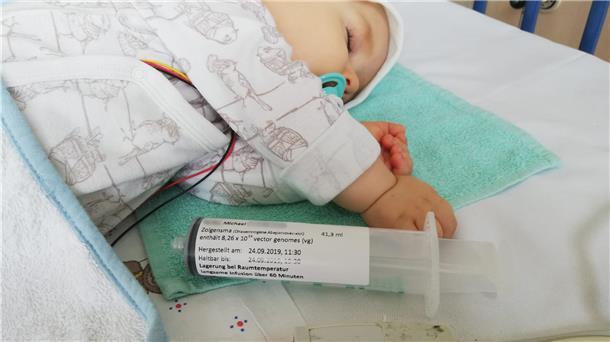 Der einjährige Michael schläft, während er eine Injektion mit dem Genpräparat Zolgensma gegen spinale Muskelatrophie bekommt.