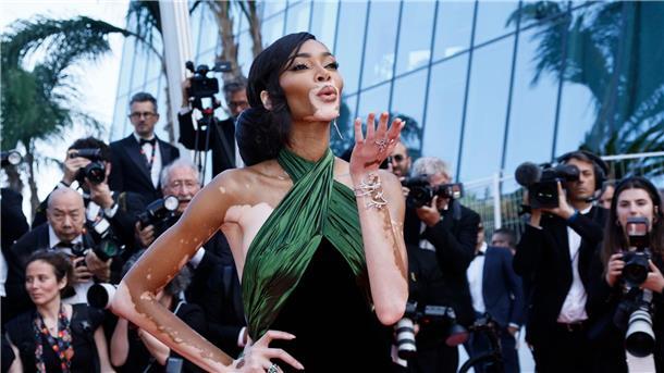 Die Modeldichte ist in Cannes besonders hoch: Auch Winnie Harlow ist dabei.