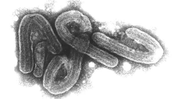 Tansania räumt Todesfall durch Marburg-Virus ein Die Präsidentin sagte, Tansania habe aus dem Marburg-Ausbruch 2023 gelernt. (Archivbild)