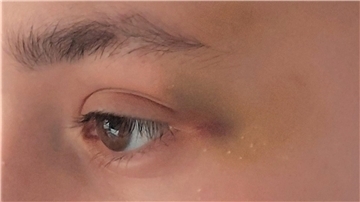 Blaues Auge