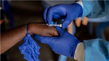 Die Zahl der Mpox-Fälle nimmt in mehreren afrikanischen Ländern weiter zu (Archivbild).