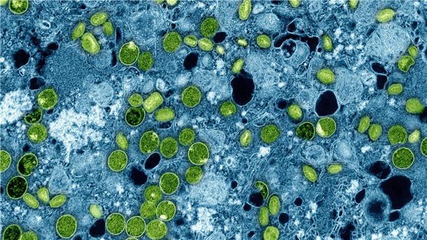 Diese kolorierte elektronenmikroskopische Aufnahme aus dem Jahr 2024 zeigt Mpox-Viruspartikel (grün). (Archivbild)