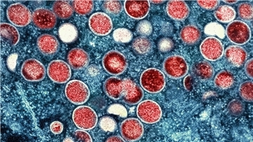 Diese Mikroskopaufnahme zeigt Mpox-Partikel in einer Zelle. 