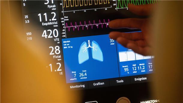 Künstliche Beatmung im Ernstfall? Diese und andere medizinische Maßnahmen können in der Patientenverfügung geregelt werden.