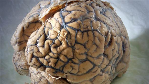 Ein Gehirn des Menschen in einem Labor der Klinik für Neurologie am Universitätsklinikum Jena.