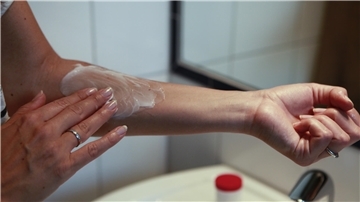 Eine Frau cremt sich am Arm ein.
