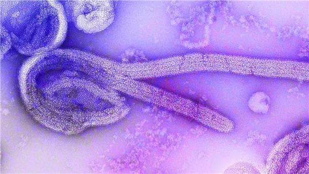 Eine elektronenmikroskopische Aufnahme des Marburgvirus.
