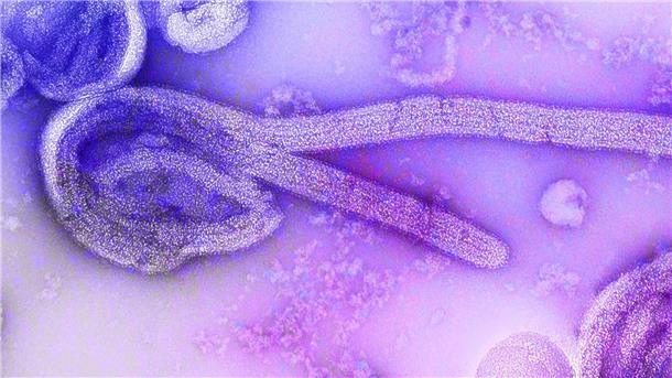 Ausbruch des Marburg-Fiebers in Äquatorialguinea Eine elektronenmikroskopische Aufnahme des Marburgvirus. Im zentralafrikanischen Äquatorialguinea ist der Ausbruch des lebensgefährlichen Marburg-Fiebers bestätigt worden. (Bild von 1968)