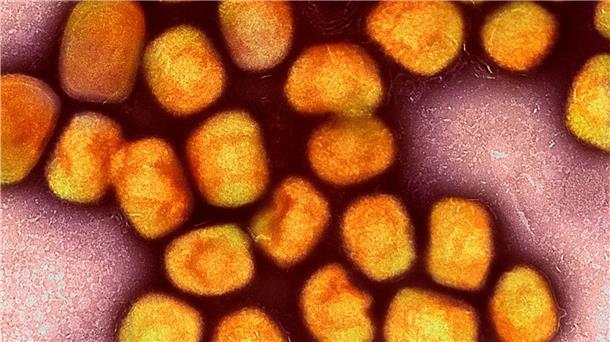 Erster Fall der neuen Mpox-Variante in Deutschland Eine kolorierte transmissionselektronenmikroskopische Aufnahme von Partikeln des Affenpockenvirus.