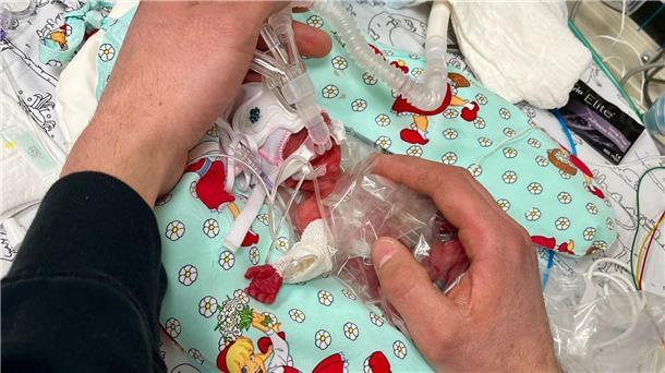 Winziges Baby mit 265 Gramm in Passau geboren Etwas mehr als ein Päckchen Butter wog die kleine Marie, als sie im Februar zur Welt kam. Seitdem ist das Kind gut gewachsen.