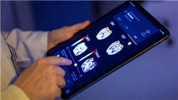 Gehirnbilder eines Patienten in einer KI-basierten App. Nach einer Deloitte-Umfrage sehen viele Bürgerinnen und Bürger den Einsatz von KI in der Medizin skeptisch, vor allem wenn es um die Therapie geht. (Symbolbild)