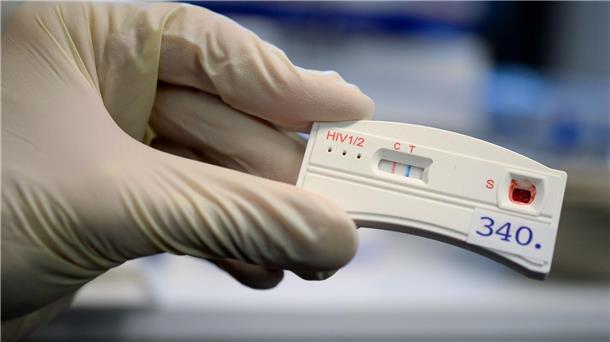 HIV-Schnelltests helfen beim erkennen der Infektion. (Archivbild)