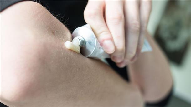 Rheuma-Studie: Niedrige Cortison-Dosen doch verträglicher In einer Studie wurden der Einfluss von geringen Cortison-Mengen auf den Blutdruck und das Gewicht von Rheuma-Patienten untersucht.