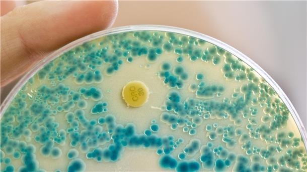 Experten fordern Anreize für Antibiotika-Forschung Indikatorkulturplatte zum Nachweis von resistenten Bakterien: Antibiotikaresistente Keime verursachen allein in der EU jährlich Zehntausende Todesfälle. (Symbolbild)