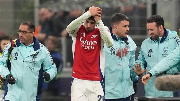 Nach Zusammenprall: Kai Havertz mit Platzwunde ausgewechselt Kai Havertz vom FC Arsenal knallte in der Schlussphase des Champions-League-Duells mit Yann Aurel Bisseck von Inter Mailand zusammen.