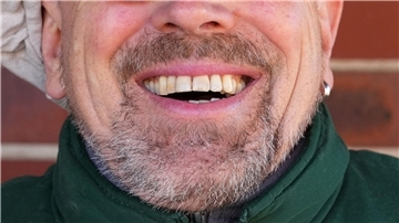 Könnte Lachen ein Therapieansatz werden?