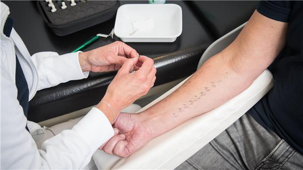 6 Tipps: Wie Sie besser mit Heuschnupfen leben Ein Arzt für am Arm eines Patienten einen Pricktest durch.