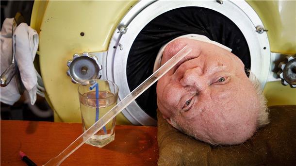 Der „Mann mit der Eisernen Lunge“ ist tot Paul Alexander war über 70 Jahre auf eine eiserne Lunge angewiesen, nun ist er gestorben.