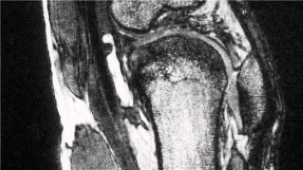Schmerzen im Knie treiben viele Versicherte zum Orthopäden - viele kommen dort mit fragwürdigen Therapien in Kontakt. (Archivbild)