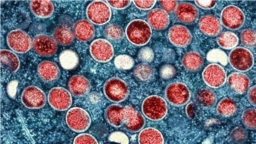 So sieht es unter dem Mikroskop aus: In der zentralafrikanischen Demokratischen Republik Kongo breitet sich das Mpox-Virus aus.