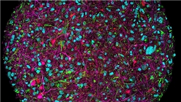 Vergrößertes Bild eines im Labor gezüchteten Hirnorganoids mit Fluoreszenzmarkierung für verschiedene Zelltypen.